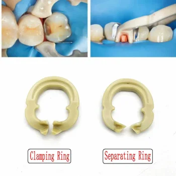 2 ks/box Zubné Živice Upevňovaciu/Oddelenie Krúžok Zubár Nástroje Autoclavable Nástroje pre Zubné Laboratória Nástroja